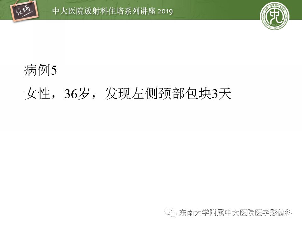 【PPT】颈部淋巴结的影像解剖及常见病变的影像表现-34