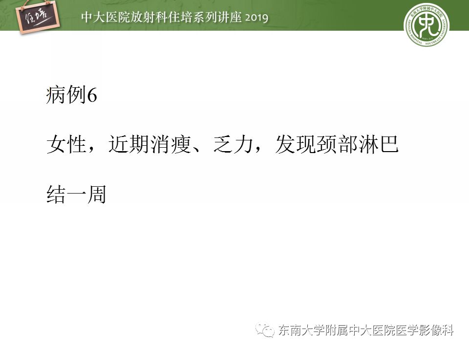 【PPT】颈部淋巴结的影像解剖及常见病变的影像表现-38