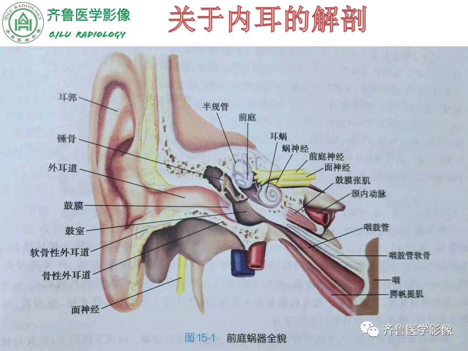【PPT】内耳畸形—耳部病变早读片病例-11