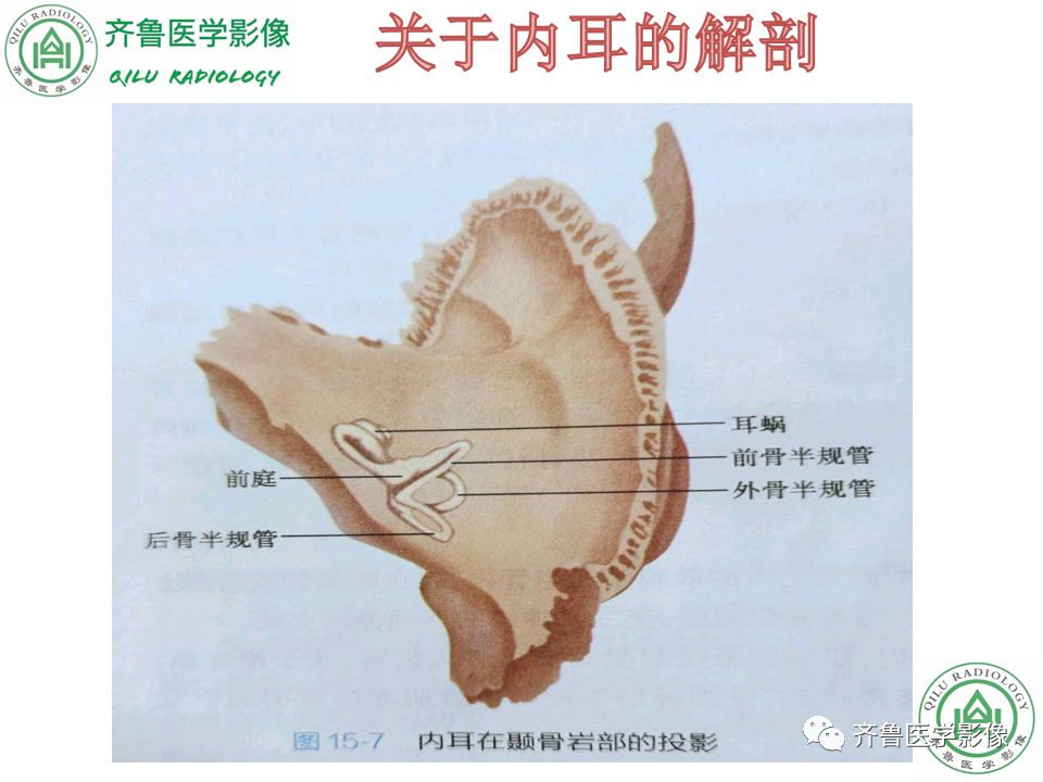 【PPT】内耳畸形—耳部病变早读片病例-12