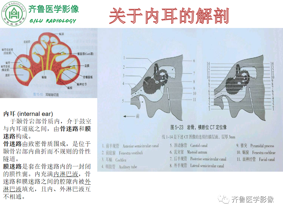 【PPT】内耳畸形—耳部病变早读片病例-13