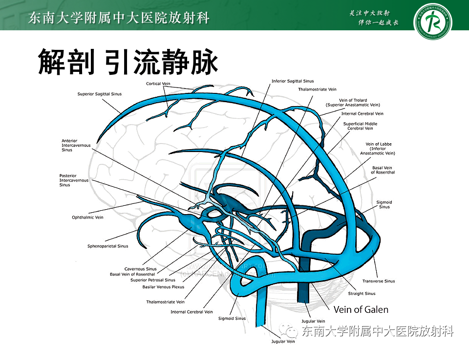 【PPT】高流量脑血管畸形-25