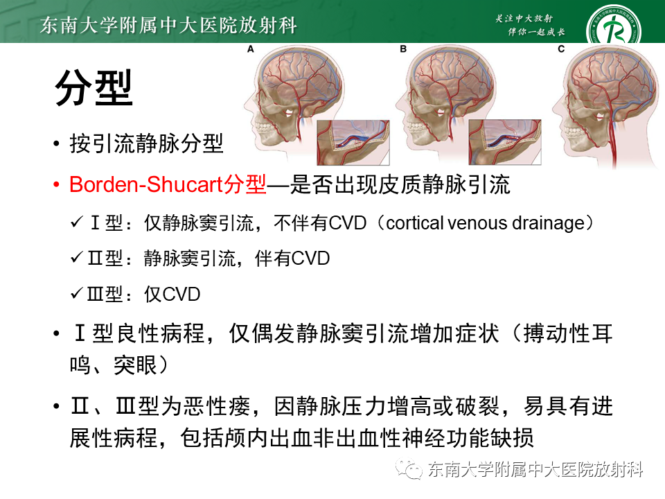 【PPT】高流量脑血管畸形-27