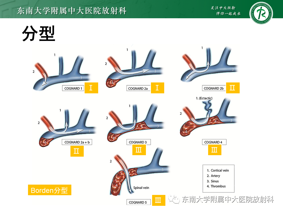 【PPT】高流量脑血管畸形-29