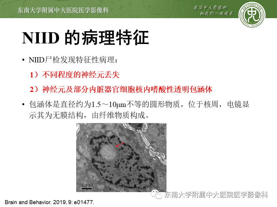 【PPT】神经元核内包涵体病（NIID）的影像学诊断-8