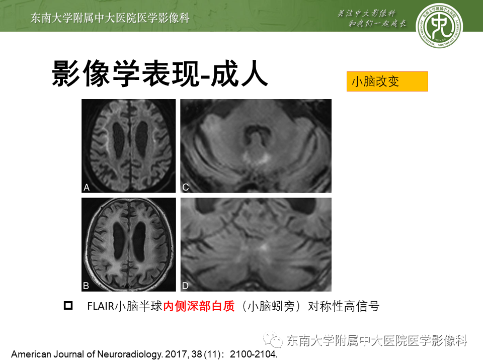 【PPT】神经元核内包涵体病（NIID）的影像学诊断-22