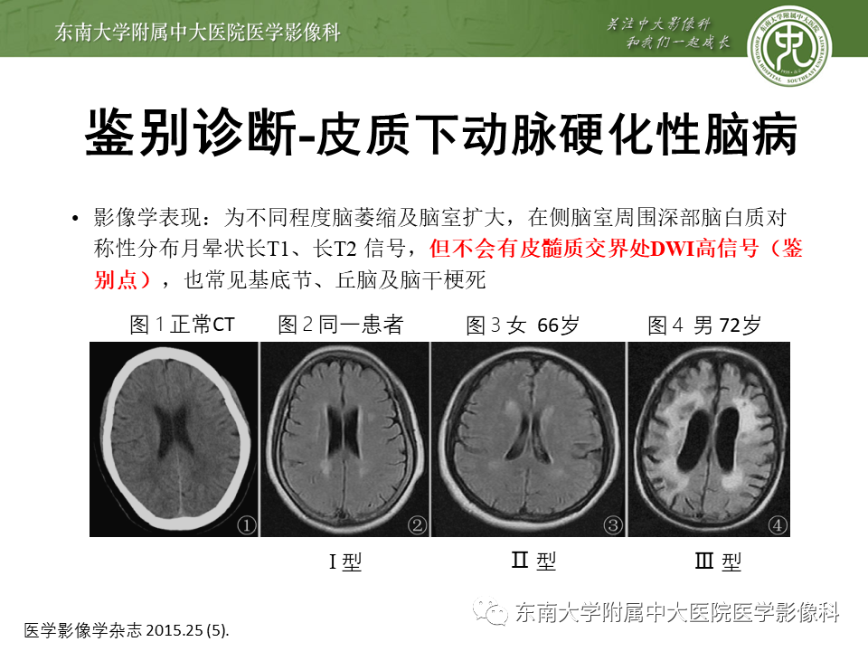【PPT】神经元核内包涵体病（NIID）的影像学诊断-31