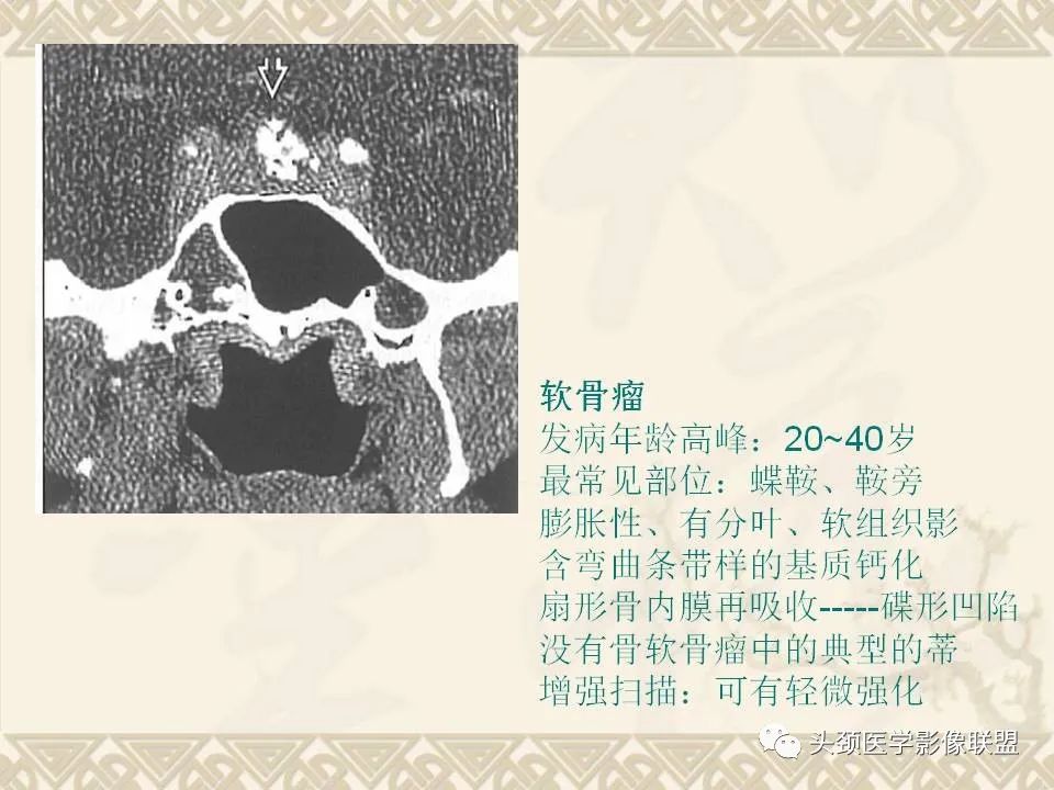 【PPT】颅骨肿瘤的影像学诊断与鉴别诊断-92