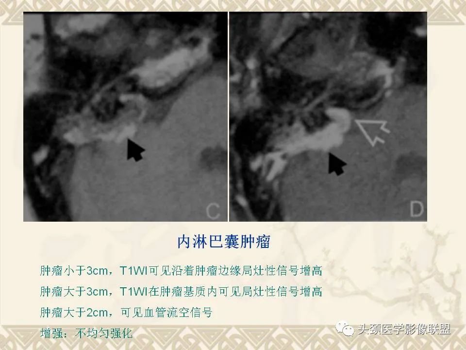 【PPT】颅骨肿瘤的影像学诊断与鉴别诊断-117