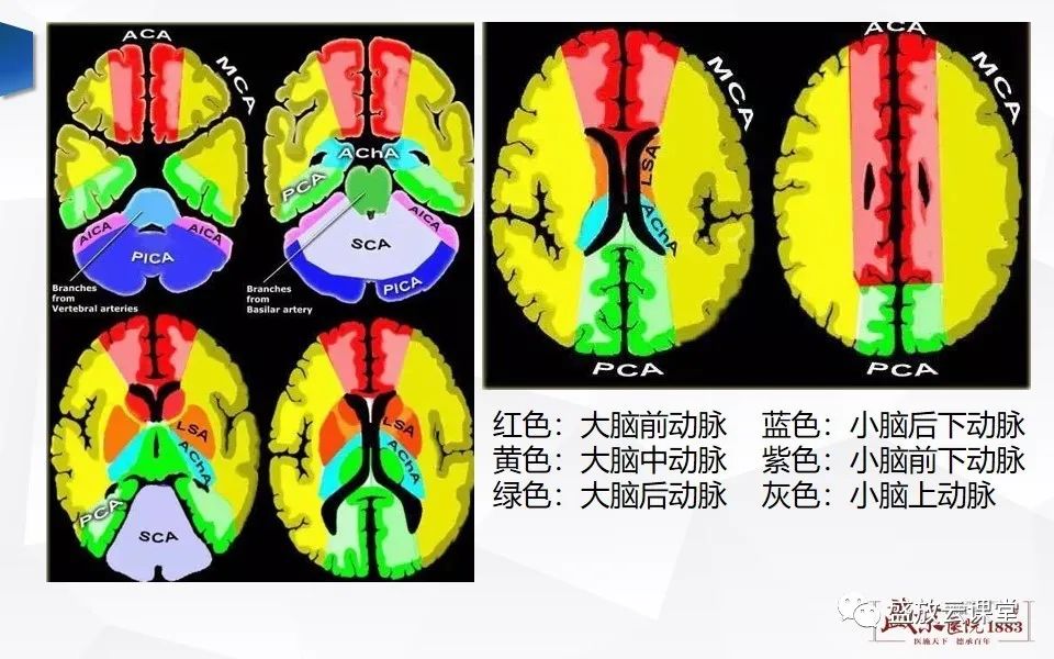 【PPT】DWI在脑卒中诊断中的作用-9