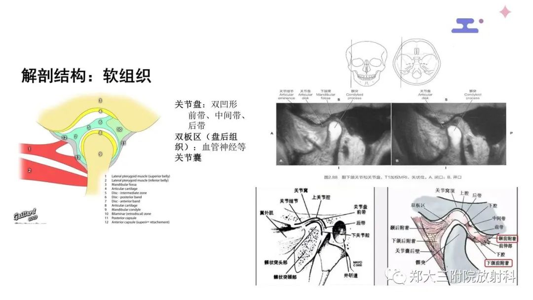 【PPT】颞下颌关节紊乱的影像学表现-6