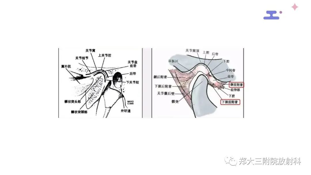 【PPT】颞下颌关节紊乱的影像学表现-9
