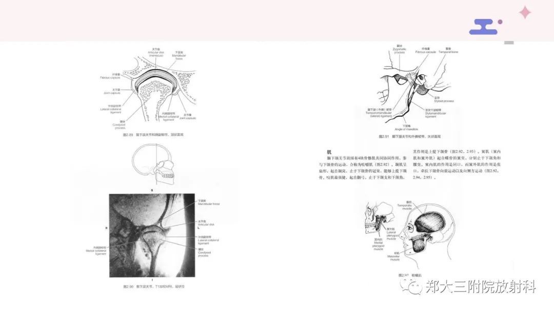 【PPT】颞下颌关节紊乱的影像学表现-7