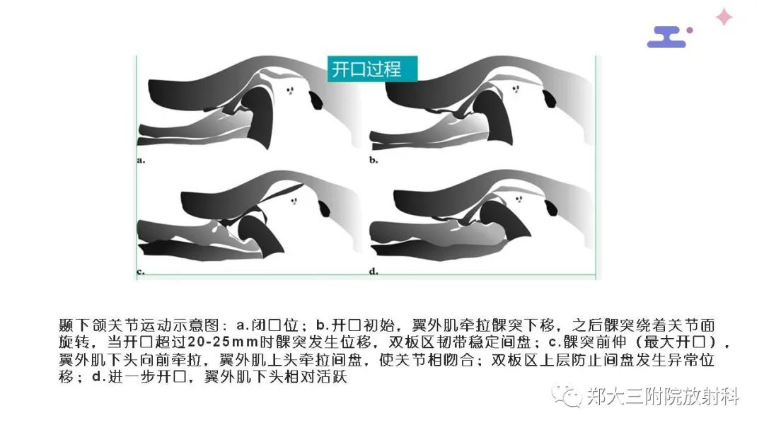 【PPT】颞下颌关节紊乱的影像学表现-18