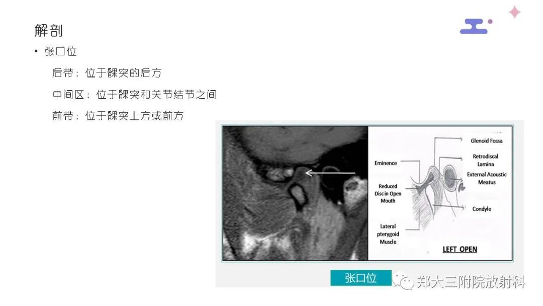 【PPT】颞下颌关节紊乱的影像学表现-14