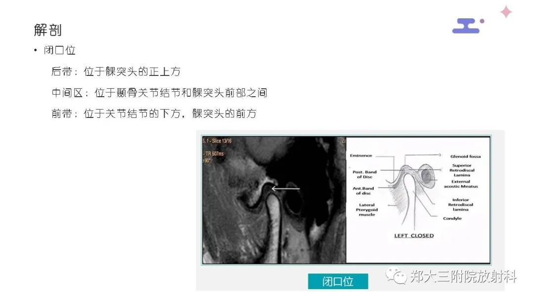 【PPT】颞下颌关节紊乱的影像学表现-13
