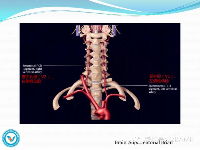 【PPT】椎-基底动脉系统解剖-7