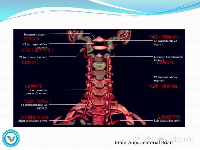 【PPT】椎-基底动脉系统解剖-8