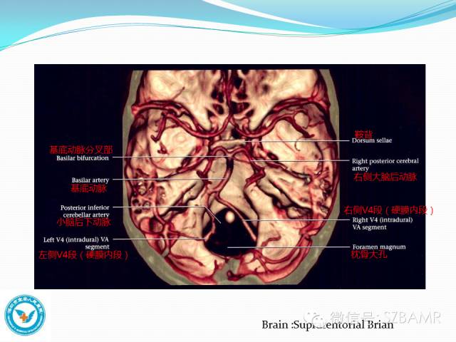 【PPT】椎-基底动脉系统解剖-11
