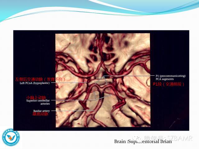 【PPT】椎-基底动脉系统解剖-12