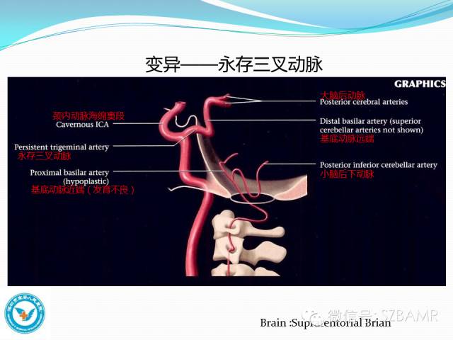 【PPT】椎-基底动脉系统解剖-13