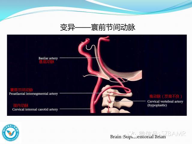【PPT】椎-基底动脉系统解剖-15