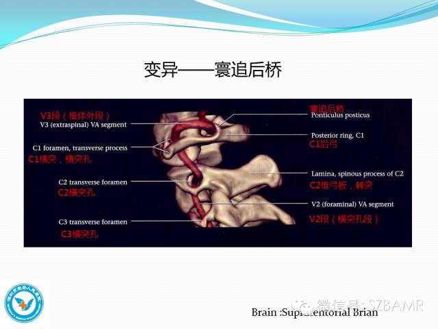【PPT】椎-基底动脉系统解剖-17