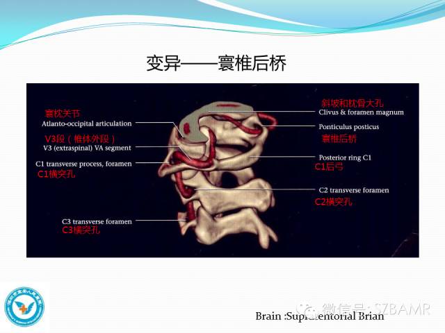 【PPT】椎-基底动脉系统解剖-18