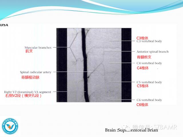 【PPT】椎-基底动脉系统解剖-19