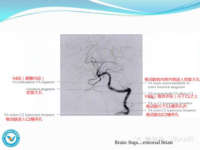 【PPT】椎-基底动脉系统解剖-21