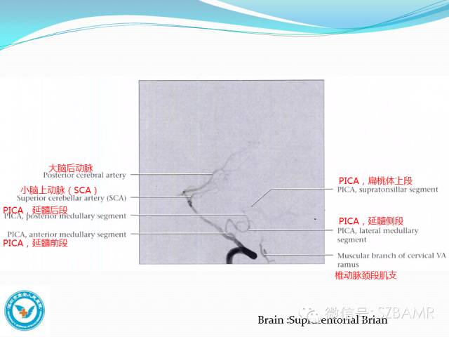 【PPT】椎-基底动脉系统解剖-22