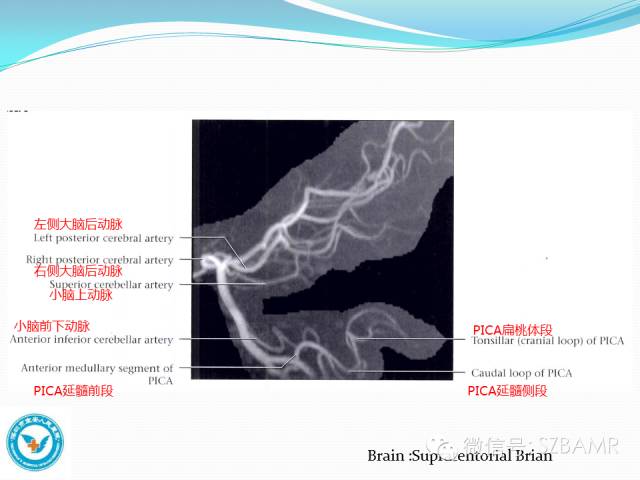【PPT】椎-基底动脉系统解剖-25