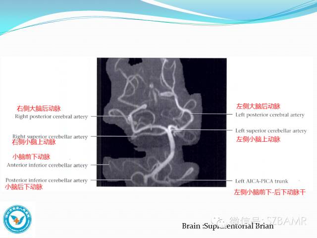 【PPT】椎-基底动脉系统解剖-26