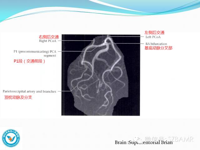 【PPT】椎-基底动脉系统解剖-27