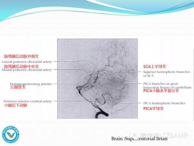 【PPT】椎-基底动脉系统解剖-2