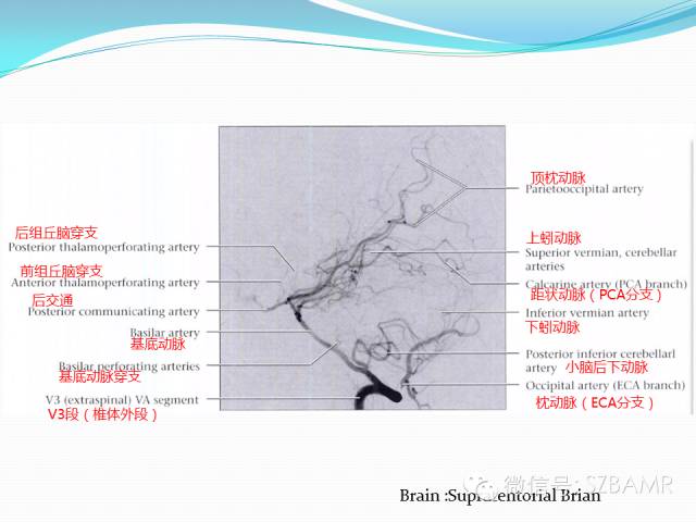 【PPT】椎-基底动脉系统解剖-1