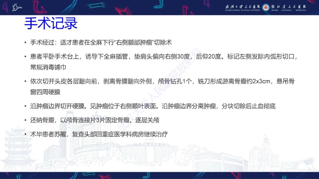 【PPT】脑多形性黄色星形细胞瘤影像诊断-7