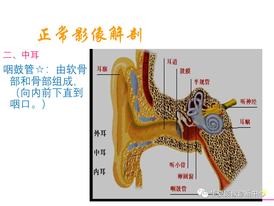 【PPT】耳的影像解剖及常见疾病诊断-6