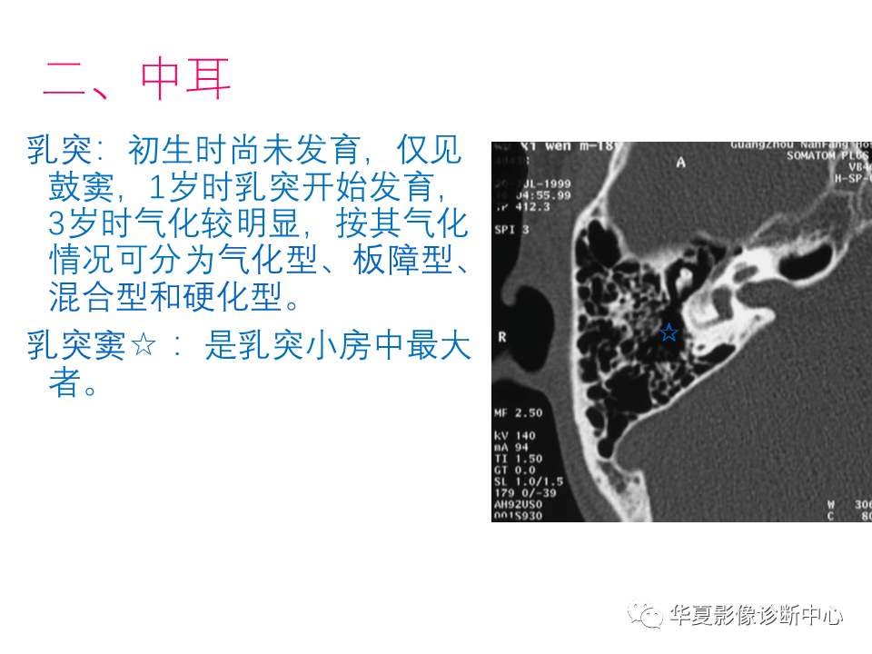 【PPT】耳的影像解剖及常见疾病诊断-12