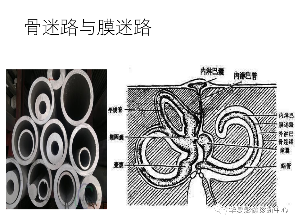 【PPT】耳的影像解剖及常见疾病诊断-29