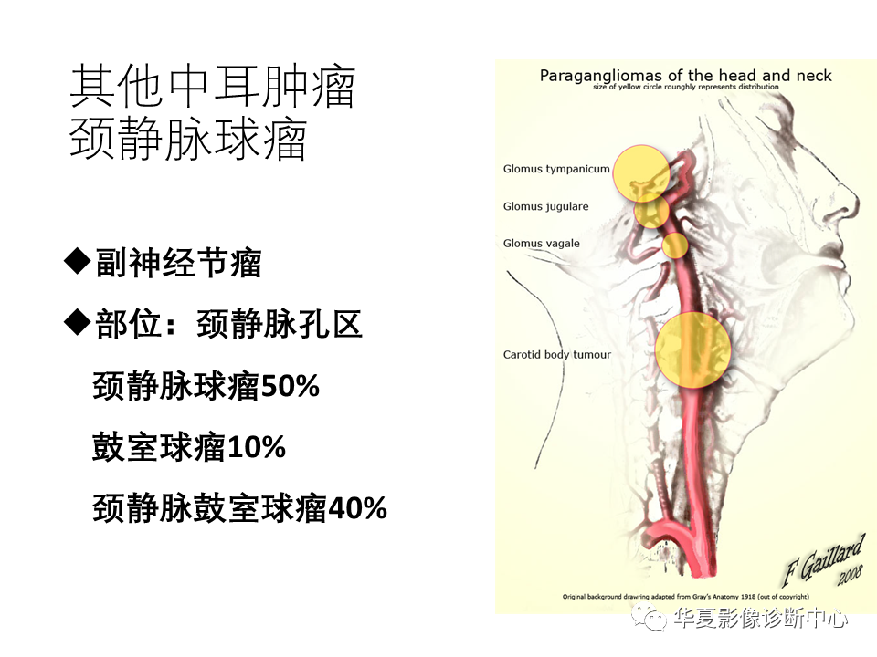 【PPT】耳的影像解剖及常见疾病诊断-63