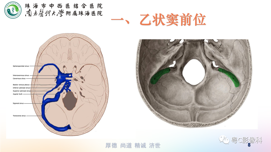 【PPT】颞骨CT检查容易忽略的两个问题-8