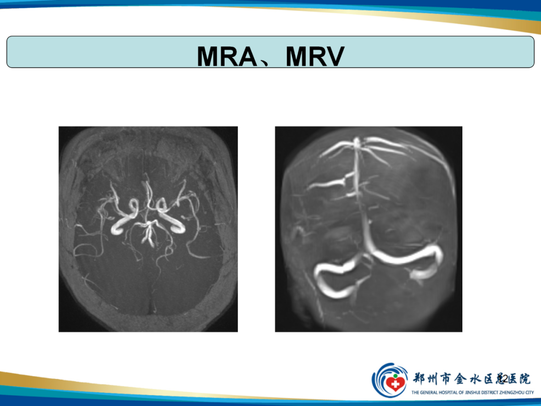 【PPT】非典型脑膜瘤影像学诊断-12