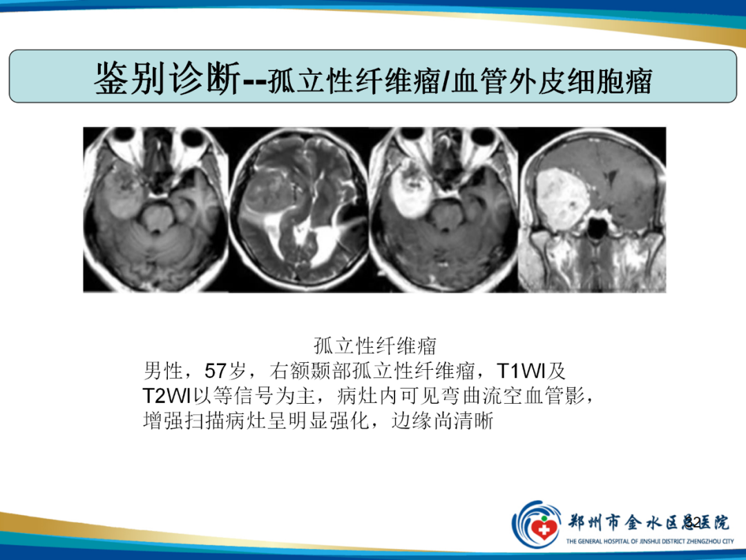 【PPT】非典型脑膜瘤影像学诊断-32