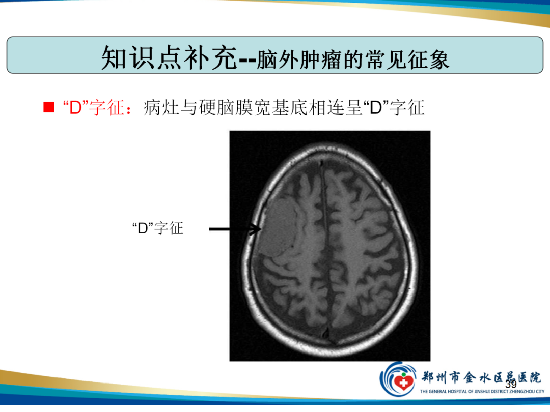 【PPT】非典型脑膜瘤影像学诊断-39