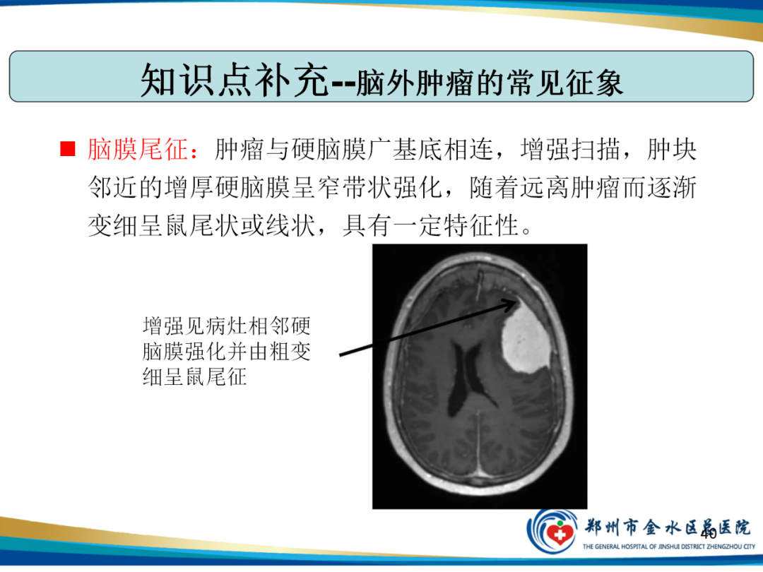 【PPT】非典型脑膜瘤影像学诊断-40