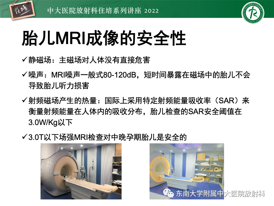 【PPT】胎儿颅脑MRI技术及常见神经系统发育异常-10