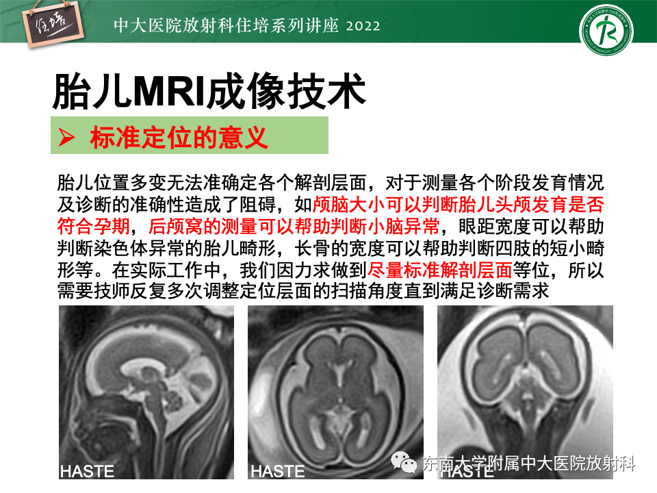 【PPT】胎儿颅脑MRI技术及常见神经系统发育异常-9