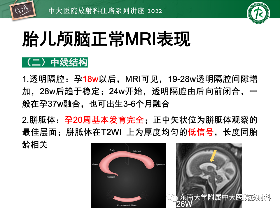 【PPT】胎儿颅脑MRI技术及常见神经系统发育异常-13