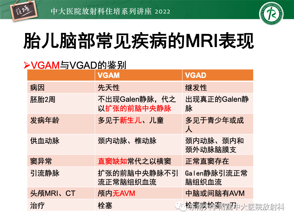 【PPT】胎儿颅脑MRI技术及常见神经系统发育异常-44